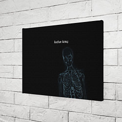 Холст прямоугольный Broken bones, цвет: 3D-принт — фото 2