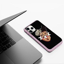 Чехол iPhone 11 Pro матовый XXXTentacion Head, цвет: 3D-розовый — фото 2