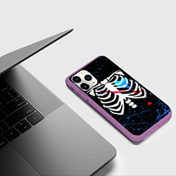 Чехол iPhone 11 Pro матовый UNDERTALE, цвет: 3D-фиолетовый — фото 2