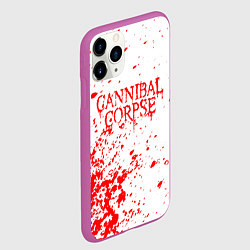 Чехол iPhone 11 Pro матовый Cannibal corpse, цвет: 3D-фиолетовый — фото 2