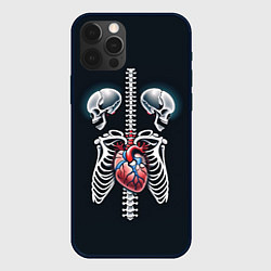 Чехол iPhone 12 Pro Max Два сросшихся скелета и сердце
