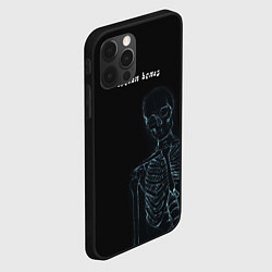 Чехол для iPhone 12 Pro Broken bones, цвет: 3D-черный — фото 2